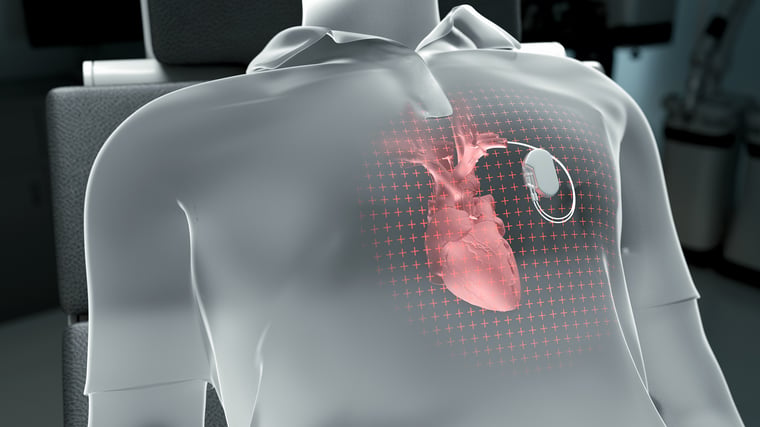 medical pace maker