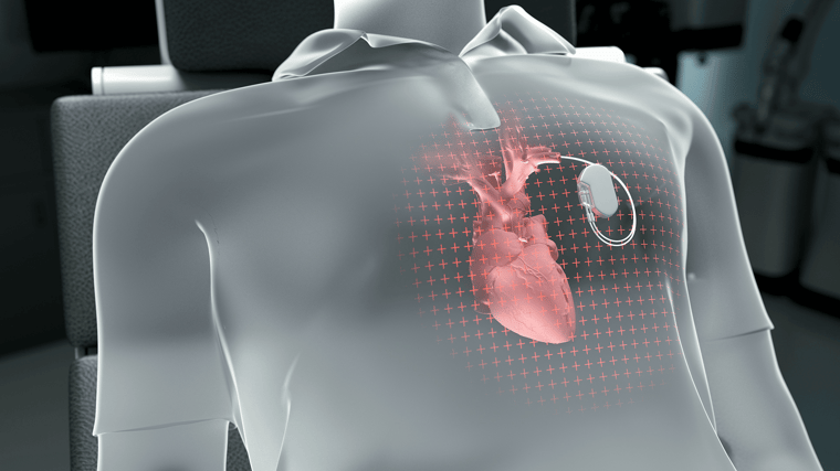 medical pace maker